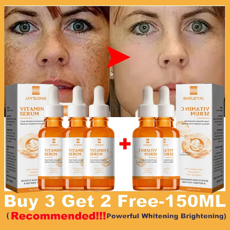 Vitamin C Whitening Serum Effective Remove Dark Spots Freckles Fade Melanin Anti-Wrinkle Brightening Nourishing Face Skin Care - NET WT Buy 3 get 2 free